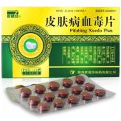 皮肤病血毒片(君碧莎)
